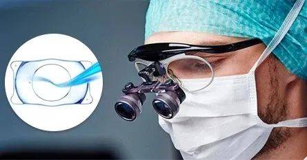 黑科技ICL晶体晚上看不清楚是为什么？一个做过手术的人的真实体验